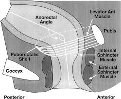 Image result for Fecal Incontinence