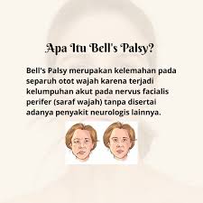 Bell's palsy adalah suatu keadaan di mana salah satu saraf kranial (saraf muka) menjadi bengkak dan radang hingga menyebabkan sebelah muka penghidapnya terasa selain itu, beberapa punca seperti faktor persekitaran, trauma atau tekanan emosi juga dikaitkan mempunyai kaitan dengan bell's palsy. Bell S Palsy Hmj Fisioterapi Pkm Facebook