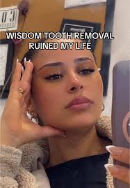 Honestly the worst pain ever. #wisdomteeth #wisdomteethaftermath