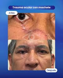 Dr. Luis Alonso Cruz Aragón