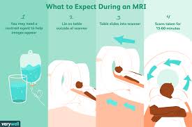 How long will it be before i get the results? Magnetic Resonance Imaging Mri Uses Procedure Results