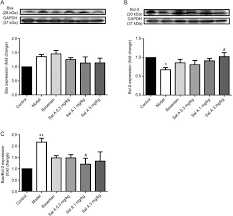 Lian hua seng group of companies. Salvianolic Acid A Attenuates Vascular Remodeling In A Pulmonary Arterial Hypertension Rat Model Acta Pharmacologica Sinica