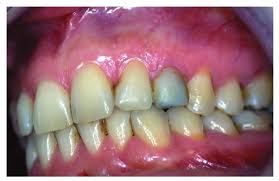 Image result for ochrana chrupu