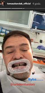 Po słowach obecnego prezesa daniela. Tomasz Karolak Zdjal Aparat Z Zebow Sensacja Z Instagrama Plejada Pl