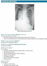 Image result for Succussion Splash