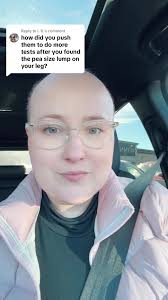 Sarcoma Knee Pictures