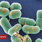  South Africa listeria: Source of 'world's worst outbreak' found