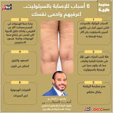فى 30 دقيقة اعرفى أحدث طريقة للتخلص من السيلوليت مع مركز دكتور أحمد السبكى اليوم السابع