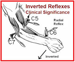 Image result for Supinator Reflex