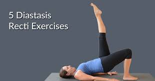 5 effective diastasis recti exercises