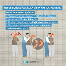 Derhal tıbbi yardım isteyin, vakit kaybetmemek adına siz heimlich manevrası yapar iken etrafınızda biri varsa 112 acil telefonu arasın. Gzt On Twitter Heimlich Manevrasi Nasil Yapilir