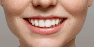 Prevent Tooth Decay Stop Teeth Damage Natural Treatments
