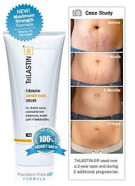 Stretch marks usually result from rapid stretching of the skin, such as pregnancy or puberty. Stretch Mark Treatment Stretch Marks Trilastin Stretch Marks Stretch Mark Cream Stretch Mark Treatment Stretch Marks