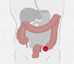 It connects with the colon close to the iliac crest of the abdominal cavity. Colostomia Ileostomia Colon Sigmoide Estomago Laparoscopia Colon Descendente Mano Sintoma Cuerpo Humano Png Pngwing
