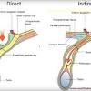 An inguinal hernia is a protrusion of the abdominal contents through an acquired or congenital area of weakness or defect in the abdominal wall just above the inguinal ligament. Https Encrypted Tbn0 Gstatic Com Images Q Tbn And9gctdmp7uji71tzbhjniq29jcejbccouvats6yipjmdehme0yjk8c Usqp Cau