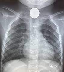 Expensive Xray 😂🤣 : r/Radiology
