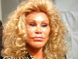 Jocelyn wildenstein denies being addicted to plastic surgery credit: Billionaire Socialite Jocelyn Wildenstein Biography Pictures Transformation
