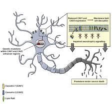 Check spelling or type a new query. Rare Variant Burden Analysis Within Enhancers Identifies Cav1 As An Als Risk Gene Sciencedirect