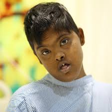 My 18-yo daughter who was born with down syndrome is dying from blood  cancer." Please help: bit.ly/SaveMekala