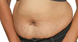 Your Post Baby Belly Why It S Changed And How To Tone It Babycentre Uk