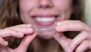 Invisalign in Thunder Bay - Viva Dental | Thunder Bay, ON, P7B 5V1