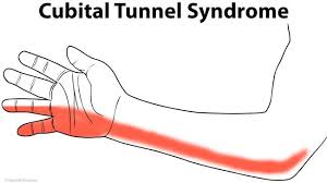 Pin On Symptoms