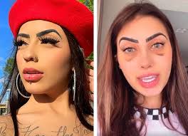 2 letras de mc mirella: Mc Mirella Mostra Rosto Roxo Apos Rinoplastia Me Atrapalhava Para Cantar Veja Antes E Depois Quem Quem News