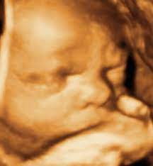 Introduction to em ultrasound @ brooklyn hospital. 3d 4d 5d Ultrasound Lowest Prices Best Service Brooklyn New York Queens Manhattan Bronx Staten Island Near Me