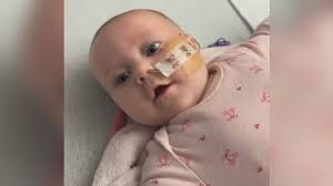 Image result for Infant Botulism