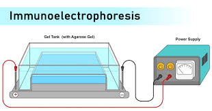 Immunoelectrophoresis Principle Procedure Results And Applications Advantages And Limitations Immunology Microbe Notes