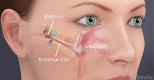 Image result for Eustachian Tube Dysfunction