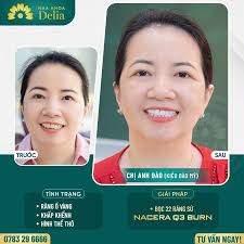 Lỗi Facebook, Messenger, Instagram, Tiktok