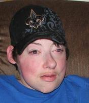 Christopher Cody Albertson (1984-2012)