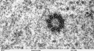 We did not find results for: Centrioles And Plastids Introducing The Cell