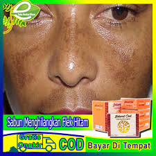 Hidung merupakan daerah yang paling sering sebagai tempat munculnya komedo. Jual Menghilangkan Flek Hitam Hidung Terbaru Lazada Co Id