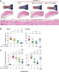 We did not find results for: Gm 1111 Reduces Radiation Induced Oral Mucositis In Mice By Targeting Pattern Recognition Receptor Mediated Inflammatory Signaling