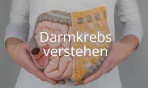 Hat der stuhl eine teerartige farbe spricht man von meläna (synonyme: Symptome Von Darmkrebs Erste Anzeichen Und Beschwerden