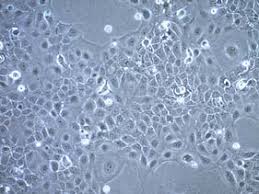 UM-SCC-47 Squamous Carcinoma Cell Line