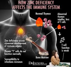 Check spelling or type a new query. 15 Zinc Deficiency Symptoms And Best Food Sources Drjockers Com