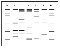 Worksheets are dna finger ing paternity work, dna finger ing lab student work, lab dna finger ing, dna finger ing, finger ing, dna forensics and color pigments activity work answer key, what is dna fingerprinting lab student worksheet. Solved Gel Electrophoresis Analysis Use The Gel Image Bel Chegg Com