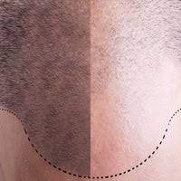 My perfect hair clinic (berlin). My Perfect Hair Clinic Gmbh Mitte Berlin Berlin