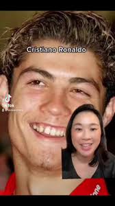 Cristiano Ronaldo Veneers: Transforming Smiles