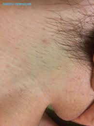 Disinfect the tweezer that you used for pubic hair only. Reader S Post A Question Of Tweezing And Plucking Pubicstyle