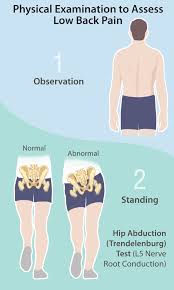 Image result for Low Back Exam