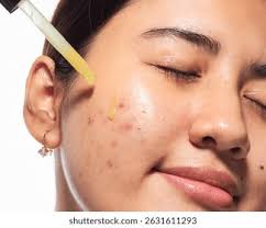 775+ Thousand Granos En La Cara Royalty-Free Images, Stock Photos &  Pictures