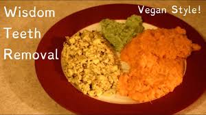 As already mentioned, wisdom teeth can get impacted or misaligned. What I Eat In A Day Wisdom Teeth Surgery Youtube