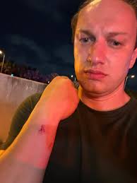 Taco down! I walked away with few bruises!