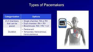 Pacemakers provide electrical stimuli to cause cardiac contraction, pacing systems consist of a pulse generator and pacing leads. An Introduction To Pacemakers Youtube