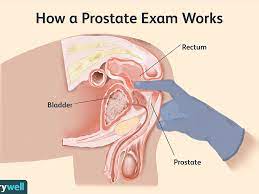 The prostate exam, or digital rectal exam (dre), allows a healthcare provider to check on the health of the prostate gland. What To Expect During A Prostate Examination