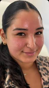 Bringing the heat to Miami. 🔥🫦 Hope your girls trip was a blast babe! ,  Dying over her gorgeous skin too. 💕, #Beautifullips #happylips #prettylips  #lips #lipfiller #lippop #kysse #kysselips ...